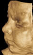 Ultrasound image with 3D Capability